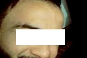 زوج اردني يقلع عيني زوجته
