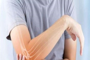 ما هي أعراض نقص البروتين في الجسم؟