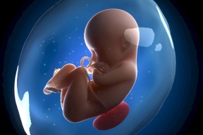 طفلة تختفي في رحم أمها وتترك لتوأمها ذكرى غريبة!
