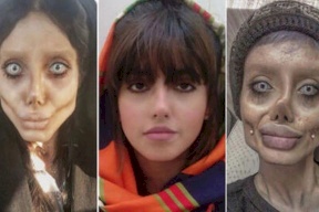 "أنجلينا جولي إيران" من الحجر للمستشفى.. كورونا فتك برئتيها