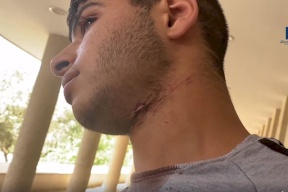 مستوطن يحاول ذبح فتى مقدسي