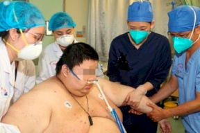 شاهد بالفيديو: الرجل الذي زاد وزنه 100 كلغ لشدة خوفه من كورونا