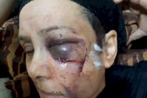 ضرب أمه المسنة وأغرقها بدمائها.. لكنها توسلت للشرطة بعدم إيذائه