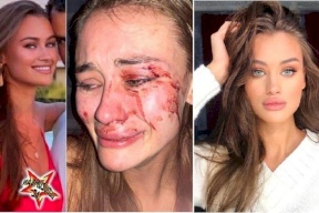 هكذا انتهت الحال بعارضة أزياء وهي تمضي عطلتها بتركيا