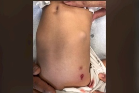 حدث في الناصرة.. بدأ الطفل بالبكاء و الصراخ ليكتشف الاهل انه مصاب برصاصتين