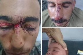 صور دامية.. سوريون ينقذون رضيعاً من أنياب ذئب!