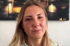 اعتداء مشين في قلب مدينة فرنسية.. والسبب "تنورة قصيرة"