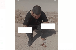 صور| في الأردن: قطع يدي فتى واقتلاع عينيه للثأر من والده!