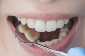 أعراض تلزمك بمراجعة طبيب الأسنان!