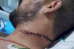 الأردن- بلطجة: مجرم يهاجم مواطنين بسيف وحالتهما حرجة!