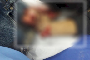 الشرطة تكشف تفاصيل جديدة عن جثة الشاب مبتورة اليدين بنابلس