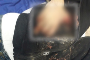 بالصور- العثور على جثة شاب مبتور اليدين قرب نابلس