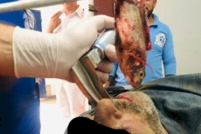 حدث فعلاً.. استخراج سمكة حية من القصبة الهوائية لصياد مصري