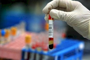 مفاجأة طبية.. أشخاص يمتلكون مناعة ضد كورونا رغم عدم إصابتهم
