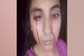 فيديو: قصة فتاة مصرية يخرج الدم من عينيها وفمها وأنفها عجز الطب عن علاجها