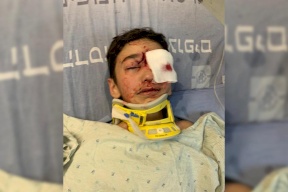 فقأ عينه.. الاحتلال يغلق التحقيق بإطلاق النار على طفل مقدسي