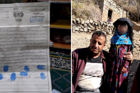 تفاصيل صادمة - قصة الطفلة اليمنية التي باعها والدها مقابل 300 دولار!