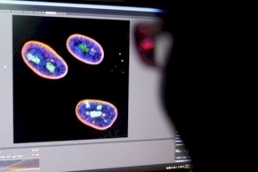 علماء صينيون يطورون علاجاً جينياً يؤخر الشيخوخة