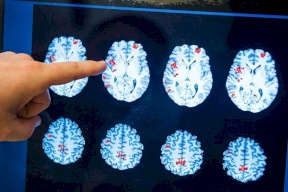 هل تنسى كثيرا؟ هذه الطريقة تساعدك على تحسين الذاكرة