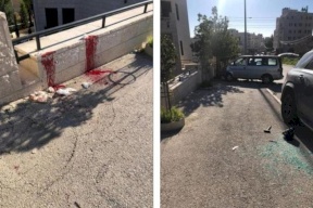 في بيت لحم: طعنوه في جميع أنحاء جسده وحاولوا ذبحه- الشرطة تعتقل مشتبهاً به