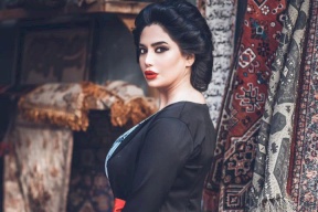 رنا الأبيض تصدم الجمهور بتشوه ملامحها.. ماذا حصل معها؟ (صورة)