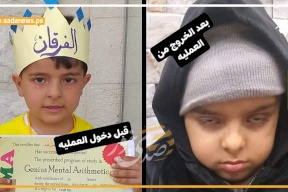 فيديو| ملهم هرشة.. طفل دخل لإجراء عملية جراحية فخرج منها أعمى!