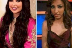 شاهد| هكذا اصبح شكلها بعد عمليات التجميل.. دنيا بطمة تفاجئ الجمهور بوجه جديد!