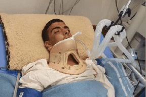 استشهاد فتى من رام الله متأثرا بإصابته برصاص الاحتلال 