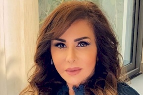مها المصري تحدث بلبلة بصورة جديدة توثق تشوّه ملامحها (شاهد)