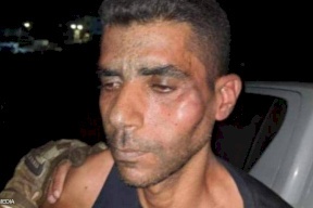 شقيق زكريا الزبيدي يوجه رسالة مؤثره له: "شو ضل بجسمك يخوي"