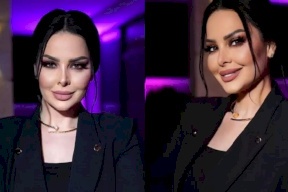 آخر صور ديانا كرزون تفاجئ الجمهور: "التجميل غيرها الى شخص آخر" (شاهد)
