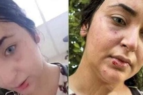 شاهد| فيديو أثار غضبا في مصر.. ضرب وسحل صيدلانية بسبب الحجاب