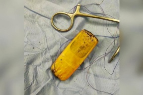 استخراج هاتف محمول من بطن مريض بمصر.. تعرف على القصة!