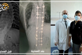 في مجمع فلسطين الطبي.. عملية خطيرة جدا تنقذ شابا يعاني من مرض محرج