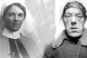 تغيرت حياتها فجأة.. سر تحول "ماري" من امرأة فاتنة الجمال لأقبح سيدة بالعالم!