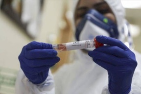 الصحة: 5 وفيات و401 إصابة بفيروس كورونا