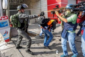 الاحتلال يصيب مواطنين بالرصاص المعدني ويعتدي على صحفيين في بيتا