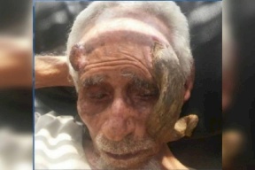 وفاة المعمر اليمني "ذو القرنين" عن عمر 140 عاما