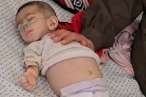 استشهاد رضيعة بفعل الجوع في غزة