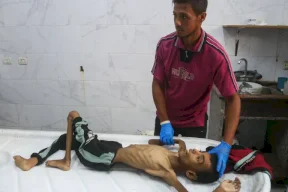 صحة غزة تُسجل 3 وفيات بمتلازمة "غيلان باريه"