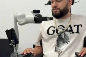 شريحة دماغية تُمكّن المرضى من تحريك أطراف روبوتية بمجرد التفكير