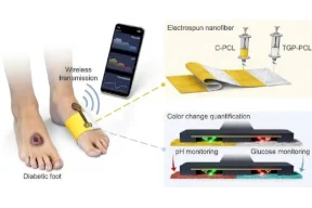 Un bandage intelligent surveille les blessures des patients diabétiques et prévient le risque d'amputation