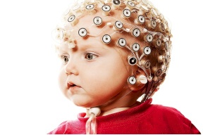 هذه هي أعراض زيادة كهرباء المخ عند الأطفال