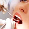 سبتمبر المقبل موعدا لبدء اختبار دواء يعيد الأسنان المفقودة