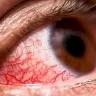 Advanced Imaging Technology.. for Early Detection of Vision Loss Diseases