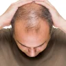 Magical Effect of Pumpkin Seed Oil on Hair Strength... But Not for Everyone