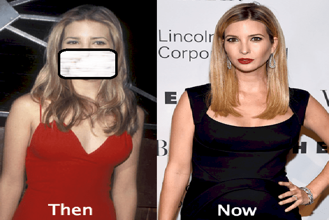 صور لن تصدقوا كيف كانت ايفانكا ترامب قبل عمليات التجميل