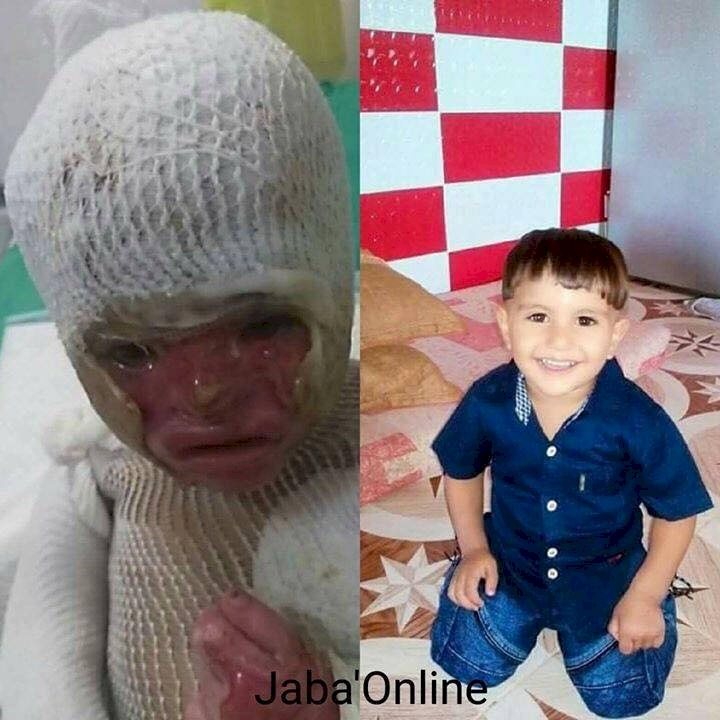 هذا ما سيحدث للطفل قيس علاونة بعد تدخل الرئيس