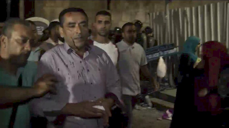 صور/ اصابات في اعتداء الاحتلال على مواطنين في القدس 