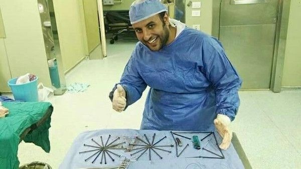 صور | لن تصدق ماذا وجد الاطباء في معدة مريض مصري!
